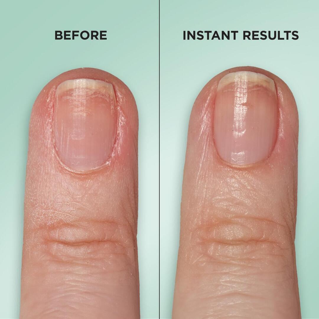 Gel Rehab Nail Repair Serum? - US 6611